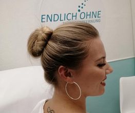 ENDLICH OHNE Tattooentfernung Berlin Bild 5
