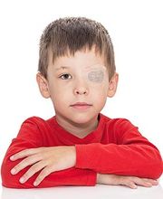 Lapeyre Groupe image 8