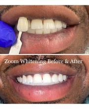 Bemiss Dental Care image 17