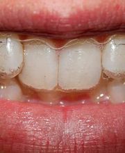 Clínica Dental Vitaldent imagen 11