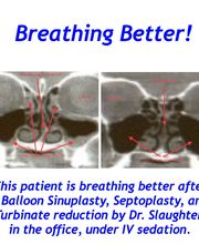 Sinus & Snoring Specialists image 18