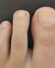 Podología clínica y deportiva Sureste imagen 14