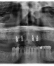 Draper Dental image 9