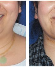 Ethos Plastic Surgery: Ginger Xu, M.D. image 6