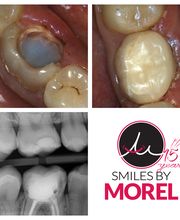 Smiles By Morel image 11