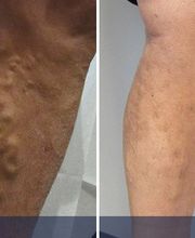 Specialty Vein Care image 3