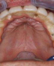 Clínica Implanteoral Milladoiro imagen 8