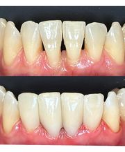Affinity Smiles image 2