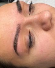 alopecia_cejas_despues_de_microblading.jpg