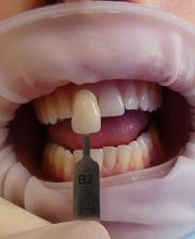 Clínica Dental Vitaldent imagen 3