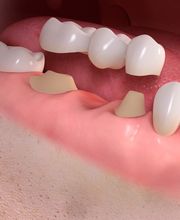 Dr.med. dent. Markus Zaruba Bild 4