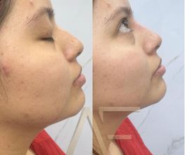 Dr Alexis Fernandez | Medicina Estetica imagen 5