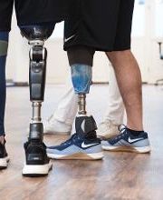 Seeger Leistungszentrum Orthopädietechnik Geneststraße - Prothesenberatung -Oberschenkelprothese und Unterschenkelprothese