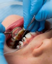 kieferorthobern Neuengasse Bild 6