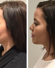 UniQ Laser Center Watertown image 10