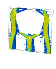 Topologieoptimierung