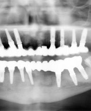 Clínica de Estética dental Láser .Algeciras.Dr Joaquín garcia rodriguez imagen 4