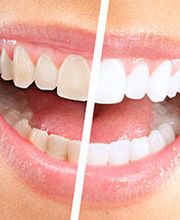 Neric Médecine dentaire I Zahnmedizin Bild 4