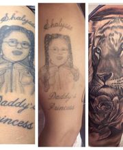 Removery Tattoo Removal & Fading image 3