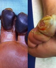 Consulta Barreiro-Vascular (Drs. A. Barreiro Mouro y J. Barreiro Veiguela) imagen 9