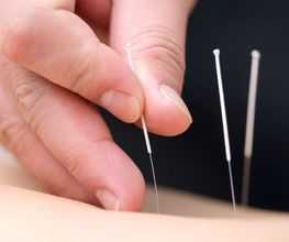 Oase TCM | Akupunktur, Chinesische Medizin für Baselland und Basel Bild 12