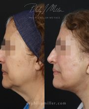 Gotham Plastic Surgery image 12