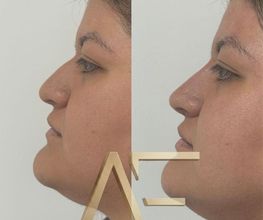 Dr Alexis Fernandez | Medicina Estetica imagen 4