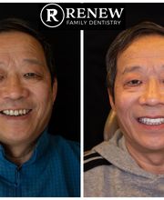Renew Family Dentistry image 6