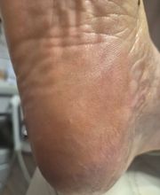 PodoAkitve Berlin Bild 20