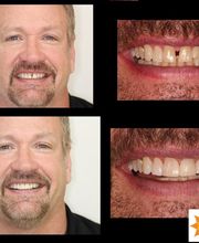 The Fort Collins Dentist Family and Implant Dentistry image 2