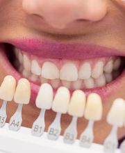 Albayzín Dental imagen 4
