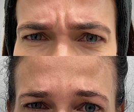 Juvenalia Brío | Botox, Hydrafacial & Ultraformer - Condesa / Roma Norte CDMX imagen 7