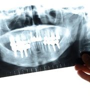 Dr méd. dent. Bühler Jean-Pierre Bild 1