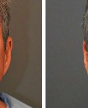 Synergy MedAesthetics image 14