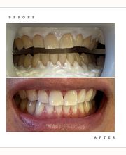 Dental Hygiene Care image 2
