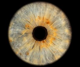 Müller Optik AG Bild 13