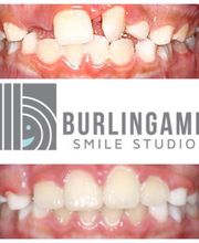 Burlingame Smile Studio Orthodontist April Lee DDS MS image 4