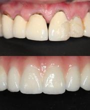 Clínica Dental Reina Victoria 66 imagen 17