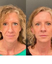 LivingYoung Center for Health & Anti-Aging image 4