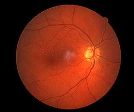 Fleury Opticiens SA Bild 9
