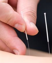 Oase TCM | Akupunktur, Chinesische Medizin für Baselland und Basel Bild 8