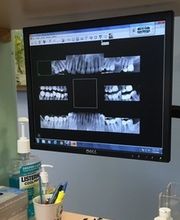 Advanced Dental Technology of Ithaca II PLLC image 5