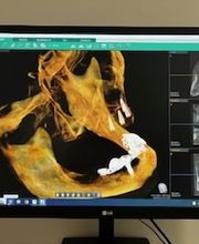 Clínica Dental Vitaldent imagen 7