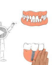 Bodensee Implantatzentrum Dr. Wolfgang Prinz MDSc Zahnarzt/ Implantologie Bild 1