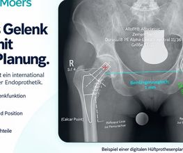 OrthoPlus Moers Bild 3
