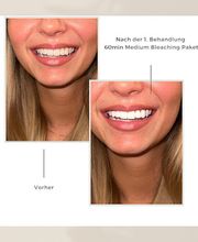 Natürlich Weiss by Asli Bild 3