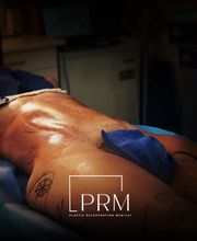 Plastic Rejuvenation Medical image 16