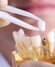 Clínica Dental López Rodrigo imagen 6