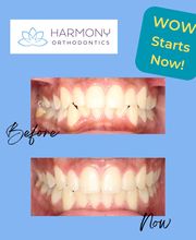 Harmony Orthodontics image 3