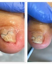 Podologische Praxis Brunsch Bild 8